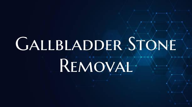 Gallbladder Stone Removal